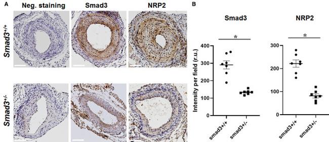 Neuropilin 2 Antibody in Immunohistochemistry (IHC)