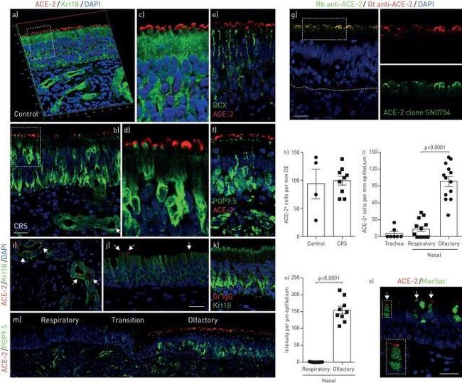 ACE2 Antibody in Immunohistochemistry (IHC)