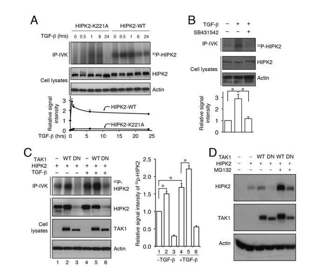 Phospho-HIPK2 (Tyr361) Antibody in Western Blot (WB)