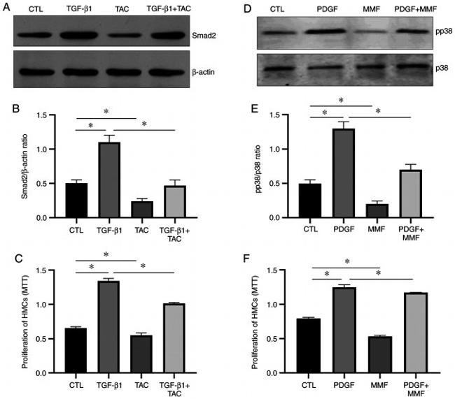 SMAD2 Antibody in Western Blot (WB)