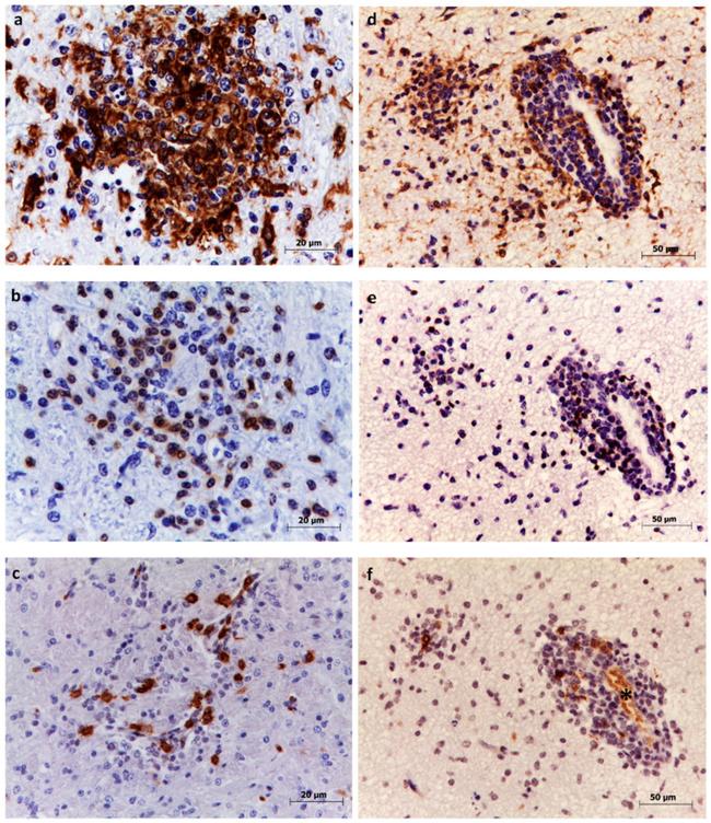 CD20 Antibody in Immunohistochemistry (IHC)