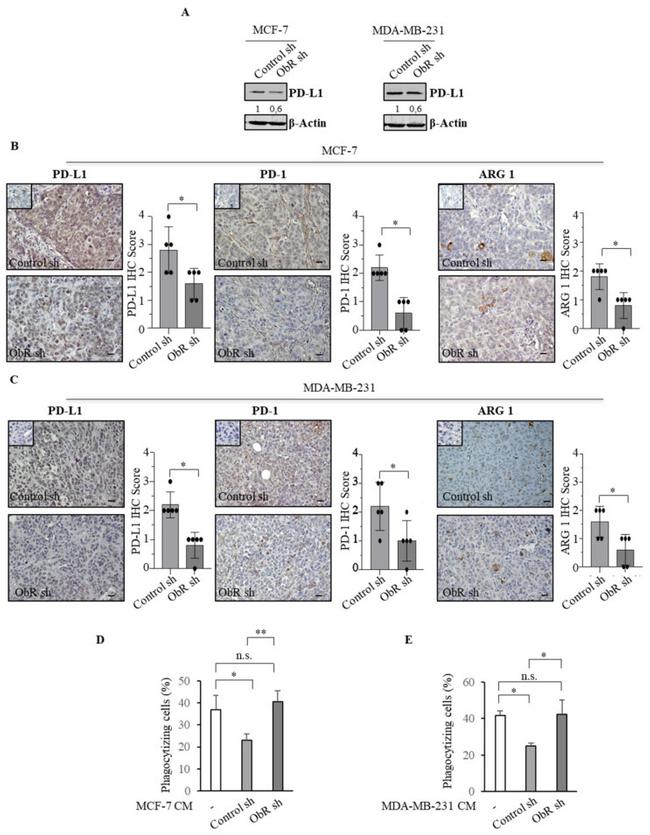 PD-1 Antibody in Immunohistochemistry (IHC)