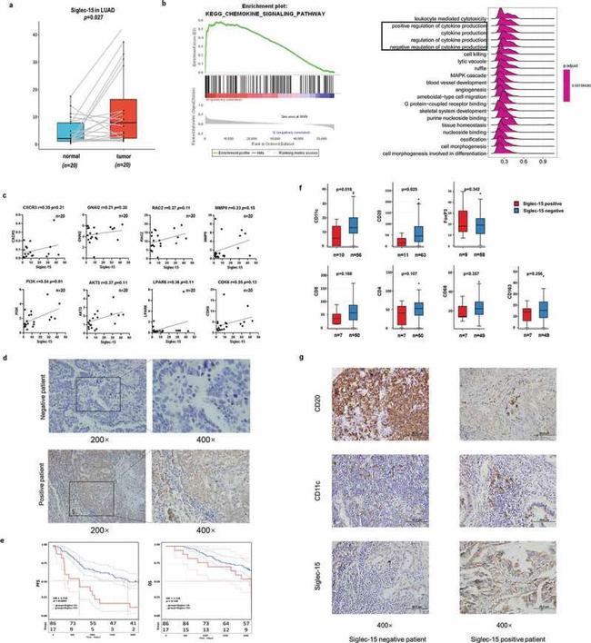 SIGLEC15 Antibody in Immunohistochemistry (IHC)