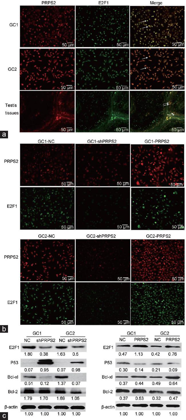 PRPS2 Antibody in Immunocytochemistry (ICC/IF)