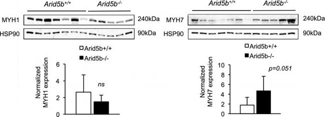 Myosin Skeletal Muscle Antibody in Western Blot (WB)