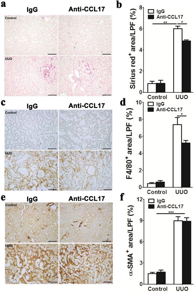 F4/80 Antibody in Immunohistochemistry (IHC)