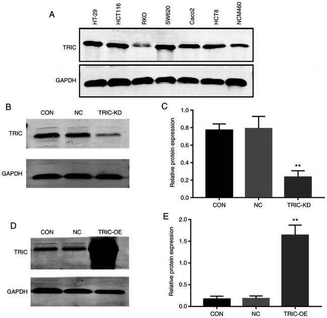 MARVELD2 Antibody in Western Blot (WB)