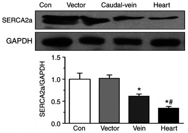 SERCA2 ATPase Antibody in Western Blot (WB)