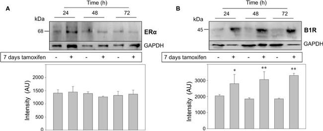 Estrogen Receptor alpha Antibody in Western Blot (WB)