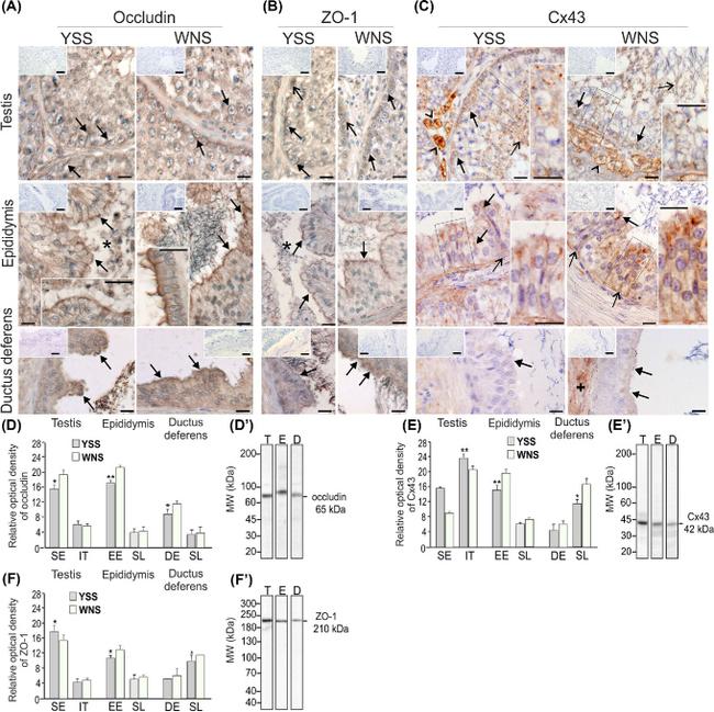 beta Catenin Antibody in Immunohistochemistry (IHC)