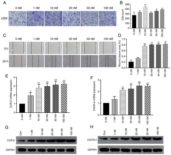 CXCR4 Antibody in Western Blot (WB)