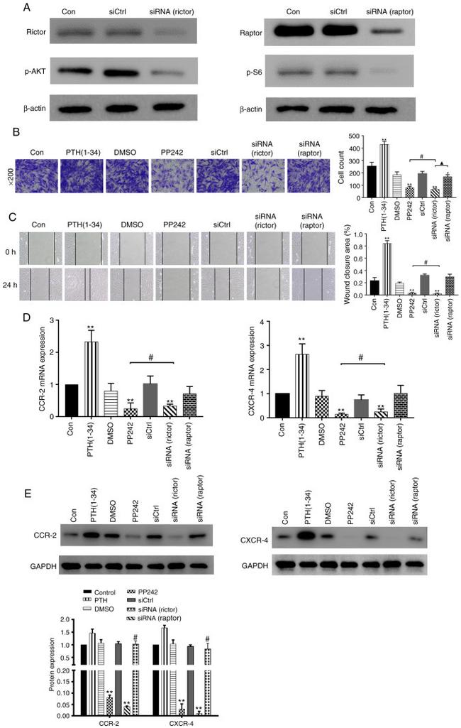 CXCR4 Antibody in Western Blot (WB)