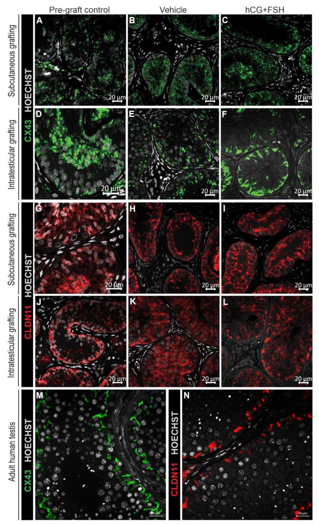 Claudin 11 Antibody in Immunohistochemistry (IHC)