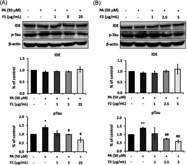 IDE Antibody in Western Blot (WB)