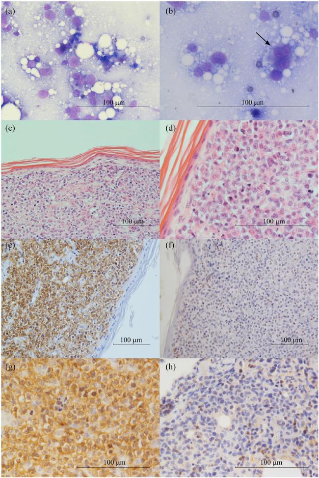 CD20 Antibody in Immunohistochemistry (IHC)