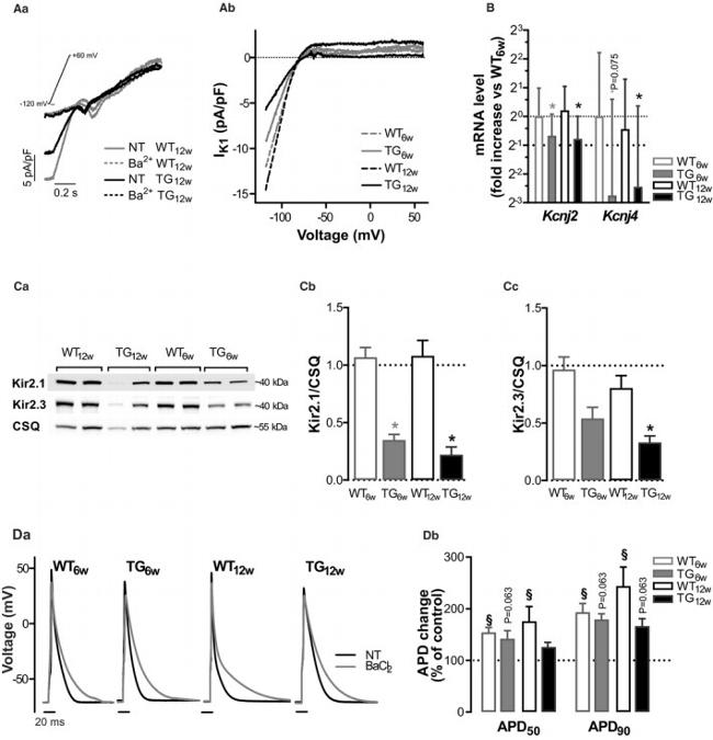 Calsequestrin Antibody in Western Blot (WB)