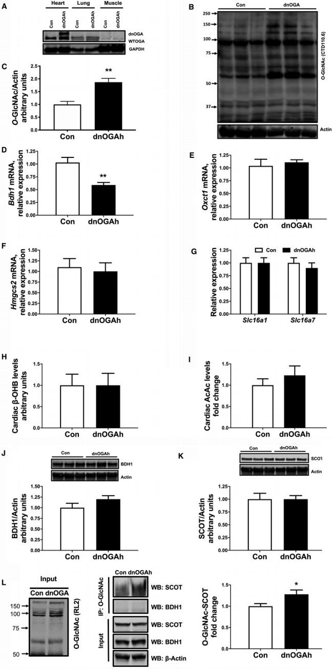 O-linked N-acetylglucosamine (O-GlcNAc) Antibody in Western Blot, Immunoprecipitation (WB, IP)