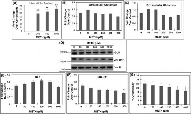 VGLUT1 Antibody in Western Blot (WB)