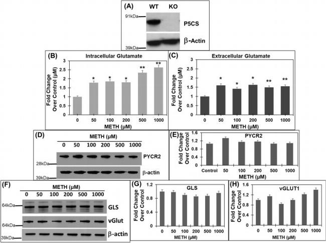 VGLUT1 Antibody in Western Blot (WB)