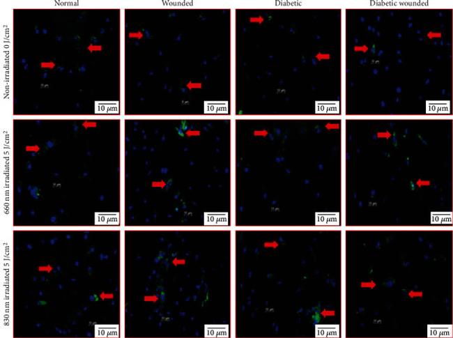 AKT1 Antibody in Immunocytochemistry (ICC/IF)