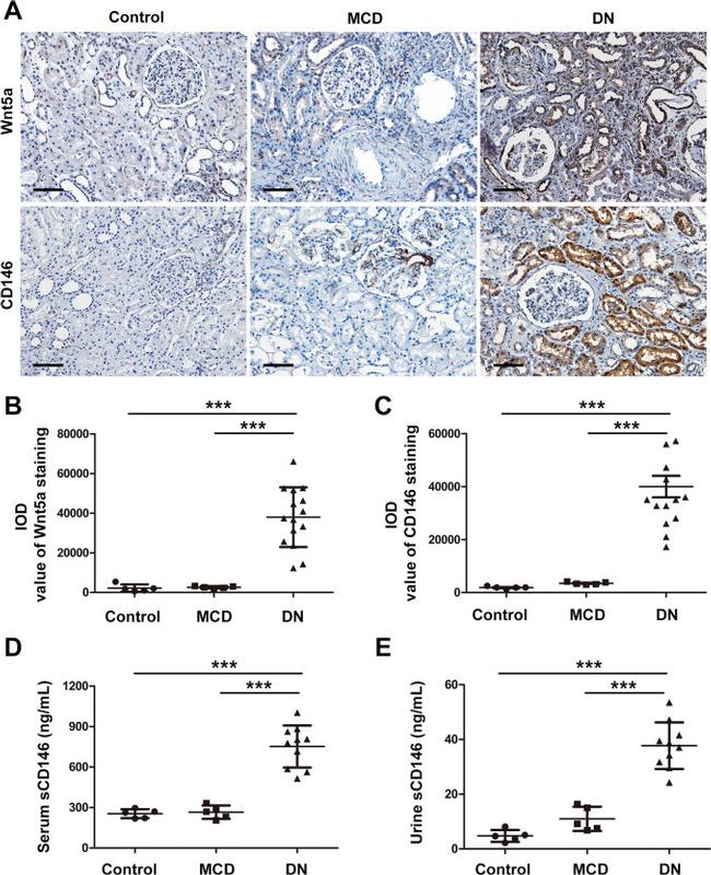 CD146 Antibody in Immunohistochemistry (IHC)