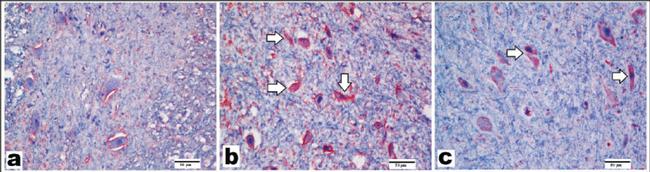 Caspase 3 Antibody in Immunohistochemistry (IHC)