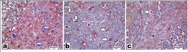 nNOS Antibody in Immunohistochemistry (IHC)