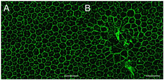 ZO-1 Antibody in Immunohistochemistry (IHC)