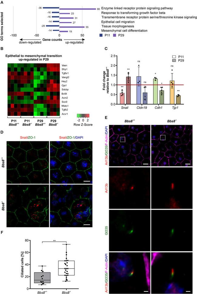 ZO-1 Antibody in Immunohistochemistry (IHC)