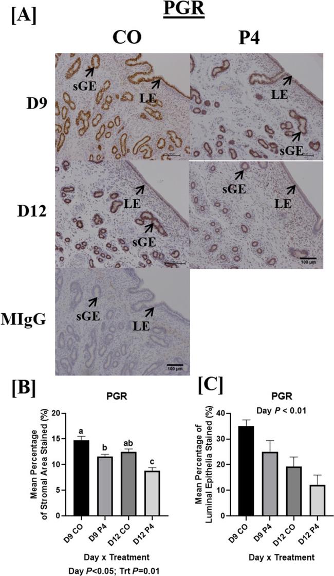 Progesterone Receptor Antibody in Immunohistochemistry (IHC)