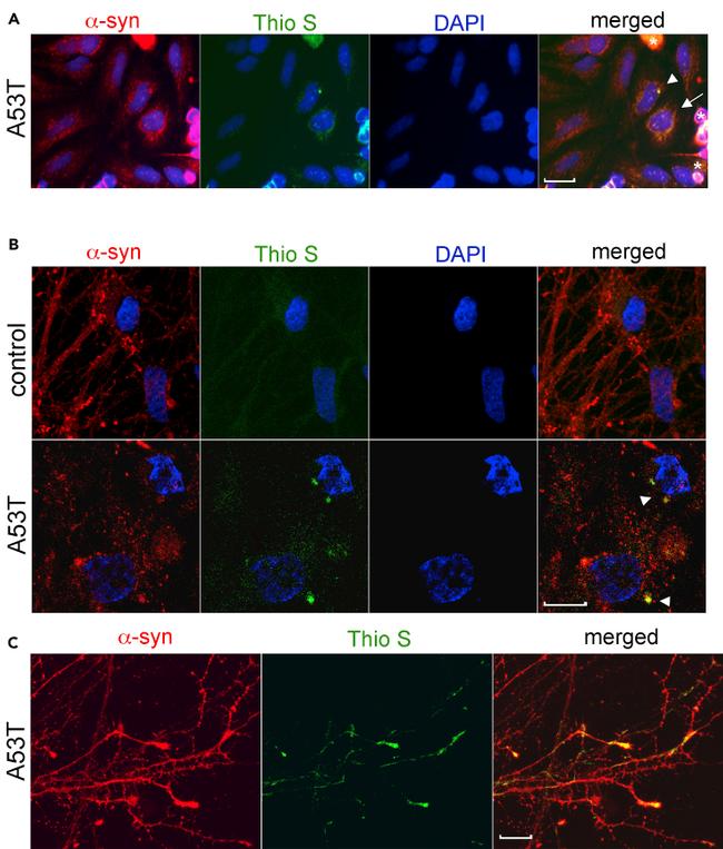 alpha Synuclein Antibody in Immunocytochemistry (ICC/IF)