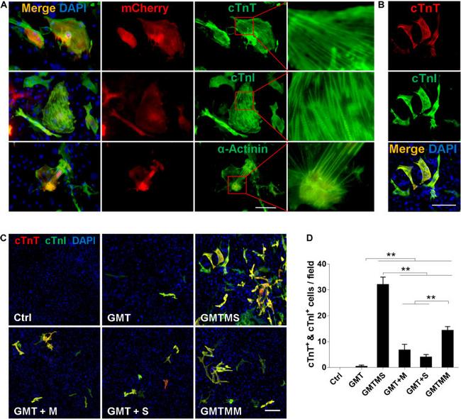 Cardiac Troponin T Antibody in Immunocytochemistry (ICC/IF)