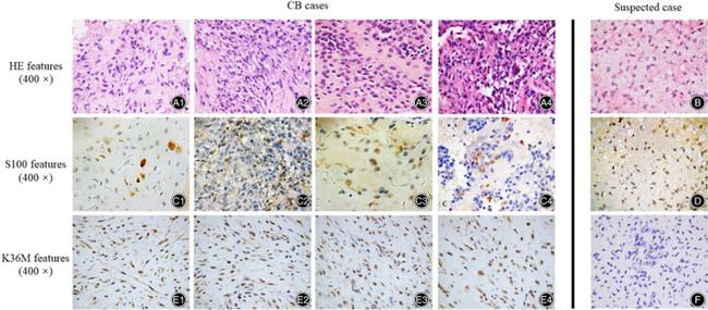 S100 Antibody in Immunohistochemistry (IHC)