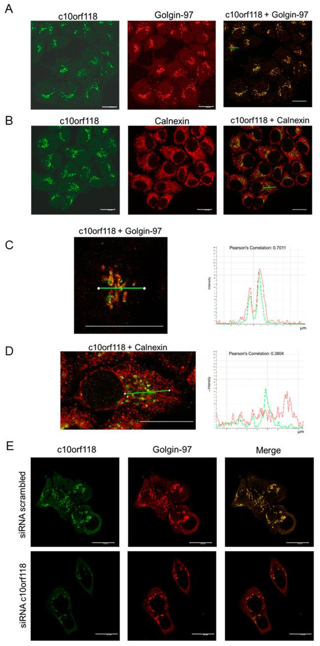 Golgin-97 Antibody in Immunocytochemistry (ICC/IF)