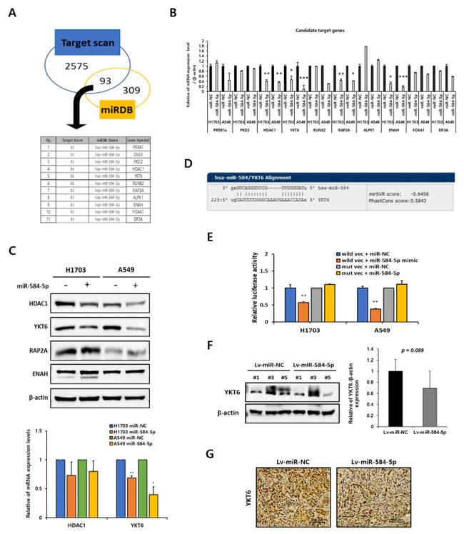 YKT6 Antibody in Immunohistochemistry (IHC)