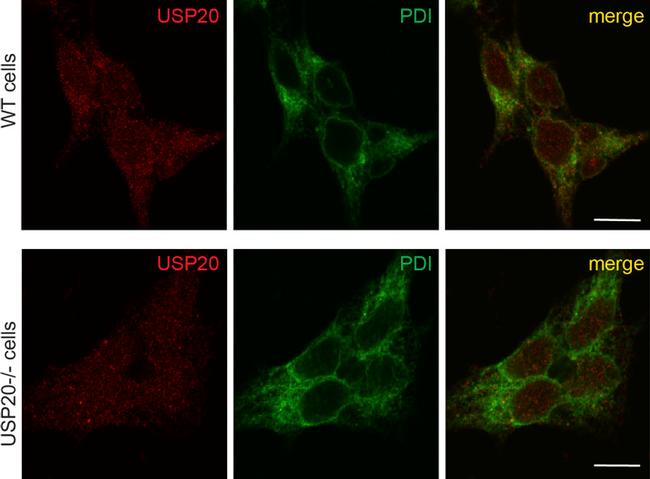 PDI Antibody in Immunocytochemistry (ICC/IF)