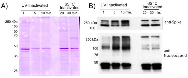 SARS/SARS-CoV-2 Nucleocapsid Antibody in Western Blot (WB)