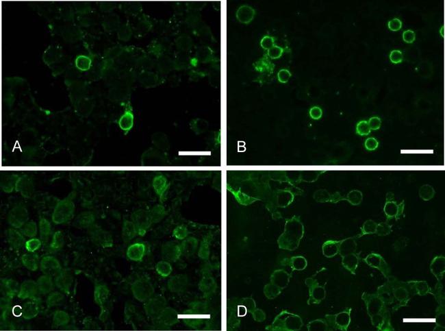 CD20 Antibody in Immunocytochemistry (ICC/IF)