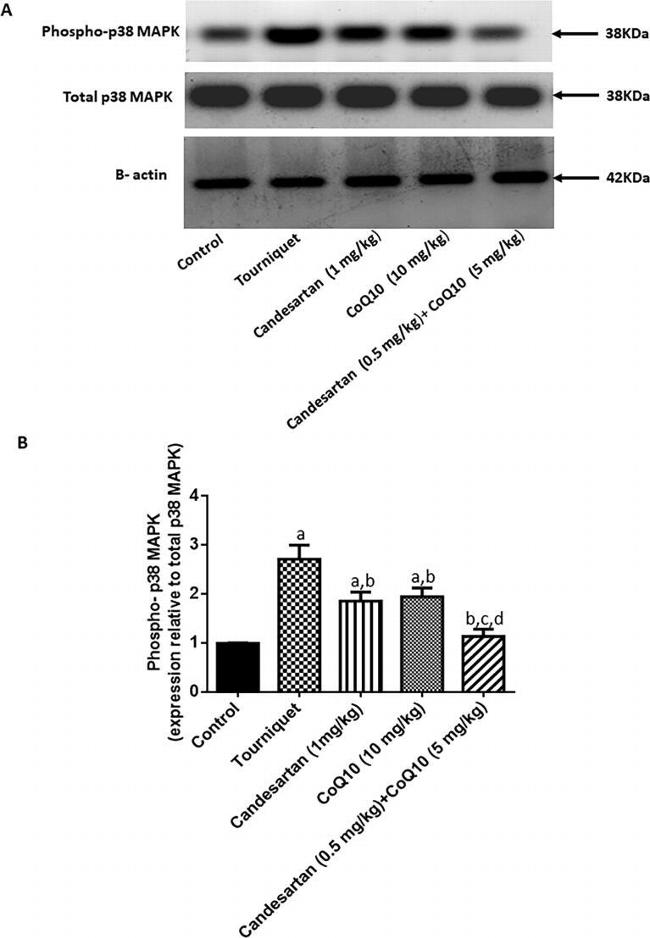 beta Actin Antibody in Western Blot (WB)