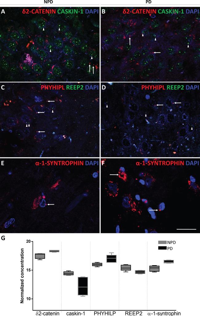 REEP2 Antibody in Immunohistochemistry (IHC)