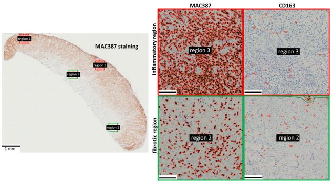 Calprotectin Antibody in Immunohistochemistry (IHC)