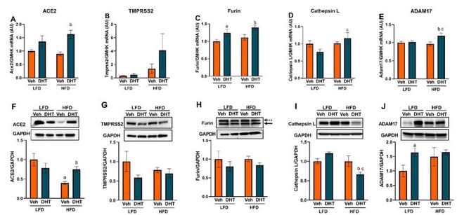 Cathepsin L Antibody in Western Blot (WB)