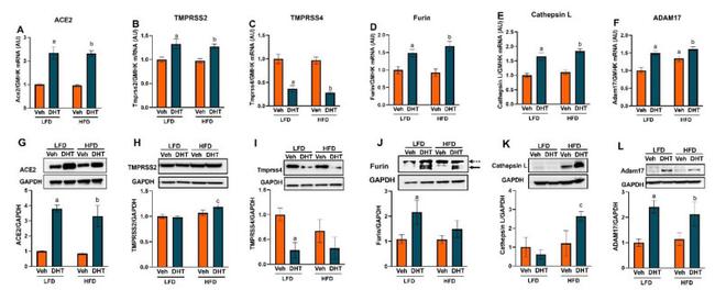 Cathepsin L Antibody in Western Blot (WB)