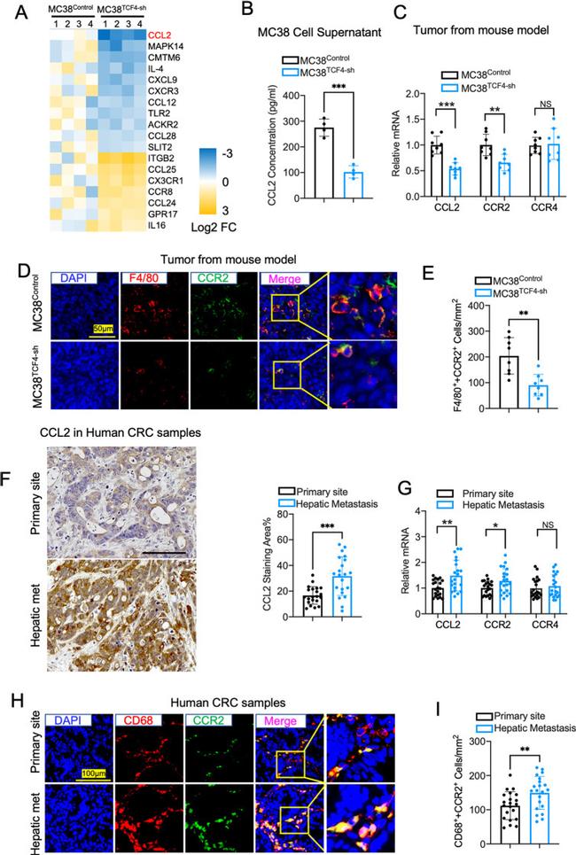 CCR2 Antibody in Immunohistochemistry (Paraffin) (IHC (P))