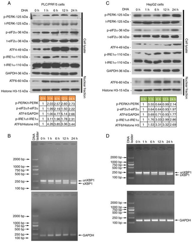 Phospho-PERK (Thr982) Antibody in Western Blot (WB)