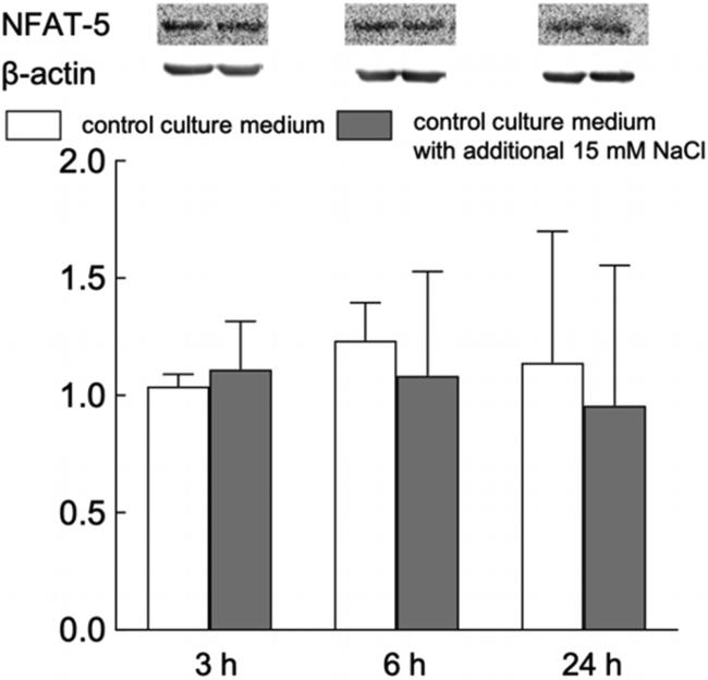 NFAT5 Antibody in Western Blot (WB)