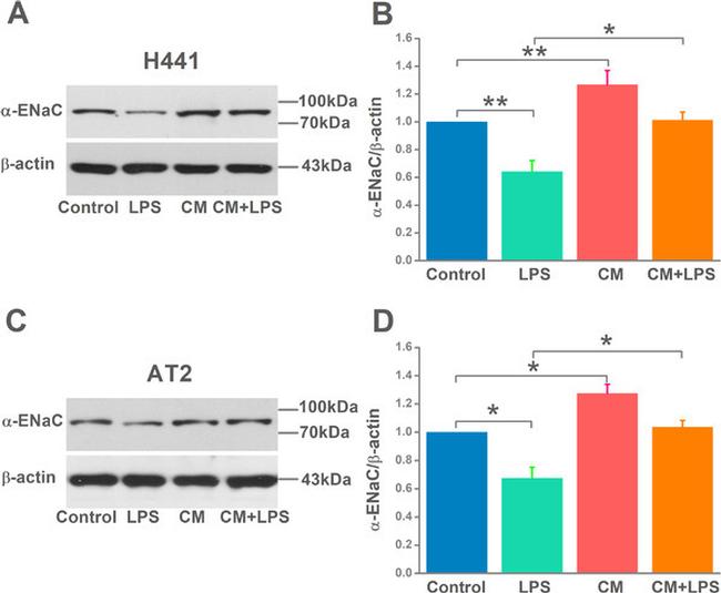 alpha-ENaC Antibody in Western Blot (WB)