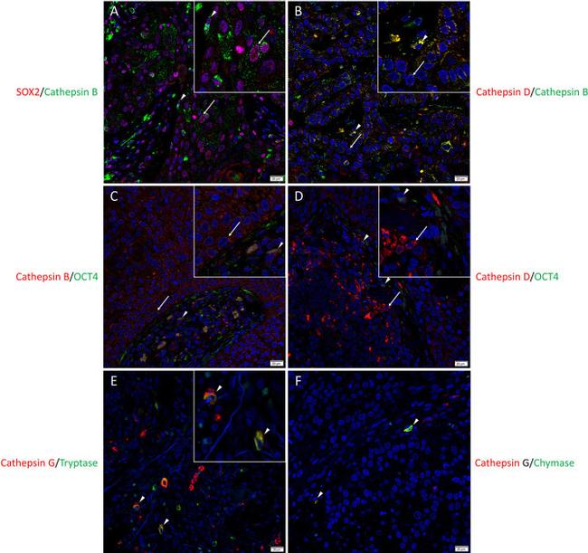 SOX2 Antibody in Immunohistochemistry (IHC)