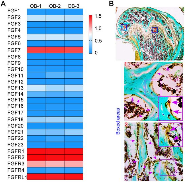 KGF Antibody in Immunohistochemistry (IHC)