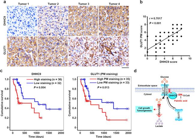 ZDHHC9 Antibody in Immunohistochemistry (IHC)